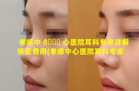 孝感中 🐘 心医院耳科专家详解矫正费用(孝感中心医院耳科专家详解 🐶 矫正费用多少钱)